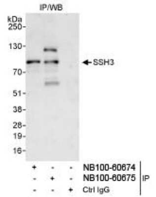 Immunoprecipitation SSH3 Antibody - BSA Free