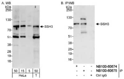 Western Blot SSH3 Antibody