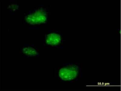 Immunocytochemistry/Immunofluorescence: SSNA1 Antibody [H00008636-B01P] - Analysis of purified antibody to SSNA1 on HeLa cell. (antibody concentration 10 ug/ml)