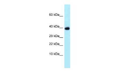 Western Blot: SSNA1 Antibody [NBP2-84285] - Host: Rabbit. Target Name: USP4. Sample Type: Jurkat Whole Cell lysates. Antibody Dilution: 1.0ug/ml