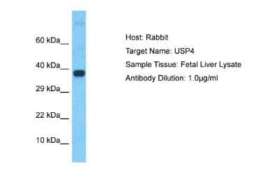 Western Blot: SSNA1 Antibody [NBP2-84286] - Host: Rabbit. Target Name: USP4. Sample Type: Fetal Liver lysates. Antibody Dilution: 1.0ug/ml