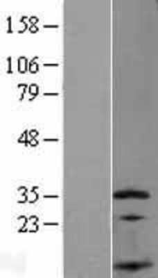 Western Blot: SSNA1 Overexpression Lysate (Adult Normal) [NBP2-07961] Left-Empty vector transfected control cell lysate (HEK293 cell lysate); Right -Over-expression Lysate for SSNA1.