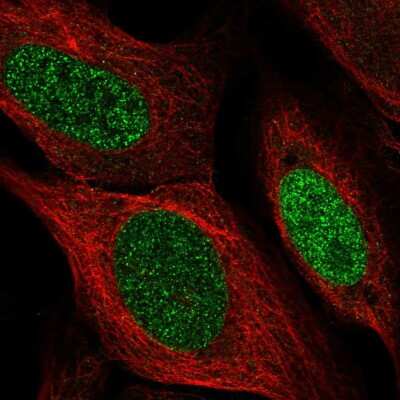 Immunocytochemistry/ Immunofluorescence SSPN Antibody