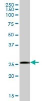 Western Blot SSPN Antibody