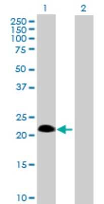 Western Blot: SSPN Antibody [H00008082-B02P] - Analysis of SSPN expression in transfected 293T cell line by SSPN polyclonal antibody.  Lane 1: SSPN transfected lysate(26.73 KDa). Lane 2: Non-transfected lysate.