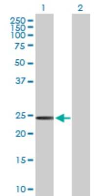 Western Blot: SSPN Antibody [H00008082-D01P] - Analysis of SSPN expression in transfected 293T cell line by SSPN polyclonal antibody.Lane 1: SSPN transfected lysate(26.60 KDa).Lane 2: Non-transfected lysate.