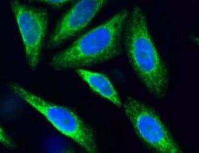 Immunocytochemistry/Immunofluorescence: SSR2 Antibody (31G6) - BSA Free [NBP2-42647] - Analysis of HepG2 cells using SSR2 antibody (31G6). Primary antibody dilution: 1:100. Image from verified customer review.