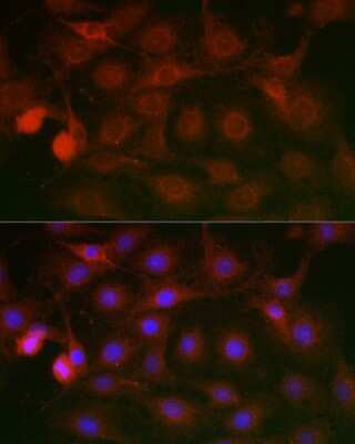 Immunocytochemistry/Immunofluorescence: SSR2 Antibody [NBP3-16018] - Immunofluorescence analysis of C6 cells using SSR2 Rabbit pAb (NBP3-16018) at dilution of 1:100 (40x lens). Blue: DAPI for nuclear staining.