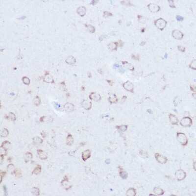 Immunohistochemistry-Paraffin: SSR2 Antibody [NBP3-16018] - Mouse brain using SSR2 Rabbit pAb (NBP3-16018) at dilution of 1:100 (40x lens).Perform high pressure antigen retrieval with 10 mM citrate buffer pH 6.0 before commencing with IHC staining protocol.