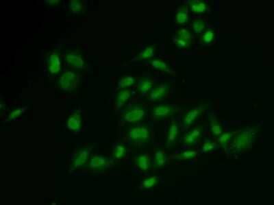 Immunocytochemistry/Immunofluorescence: SSRP1 Antibody [NBP2-93977] - Analysis of U2OS cells using SSRP1 .