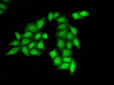 Immunocytochemistry/Immunofluorescence: SSRP1 Antibody [NBP2-94578] - Analysis of HeLa cells using SSRP1 .