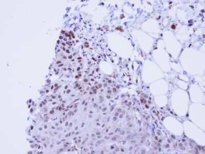 Immunohistochemistry-Paraffin: SSRP1 Antibody [NBP1-33235] - Paraffin-embedded Cal27 Xenograft, using antibody at 1:100 dilution.