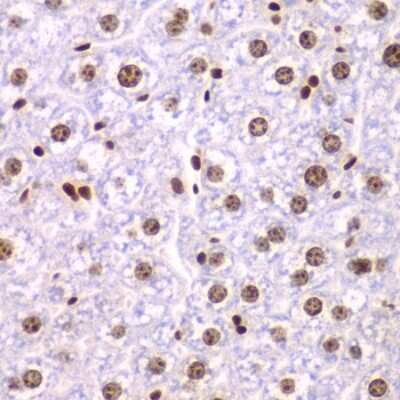 Immunohistochemistry-Paraffin: SSRP1 Antibody [NBP2-93977] - Paraffin-embedded mouse liver using SSRP1 .