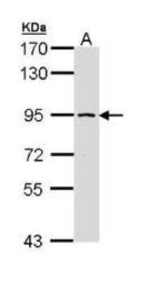 Western Blot: SSRP1 Antibody [NBP1-33235] - (30 ug of whole cell lysate) Molt-4  7.5% SDS PAGE; antibody diluted at 1:1000