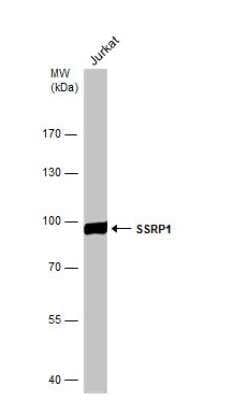 Western Blot: SSRP1 Antibody [NBP1-33235] - Whole cell extract (30 ug) was separated by 7.5% SDS-PAGE, and the membrane was blotted with SSRP1 antibody [N1N3] diluted at 1:1000. The HRP-conjugated anti-rabbit IgG antibody (NBP2-19301) was used to detect the primary antibody.