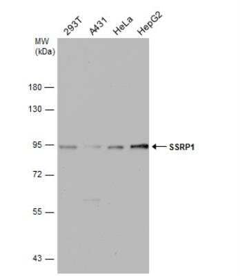 Western Blot: SSRP1 Antibody [NBP1-33235] - Various whole cell extracts (30 ug) were separated by 7.5% SDS-PAGE, and the membrane was blotted with SSRP1 antibody [N1N3] diluted at 1:1000. The HRP-conjugated anti-rabbit IgG antibody (NBP2-19301) was used to detect the primary antibody.