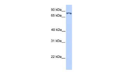 Western Blot: SSRP1 Antibody [NBP2-85824] - WB Suggested Anti-SSRP1 Antibody Titration: 0.2-1 ug/ml. Positive Control: Transfected 293T