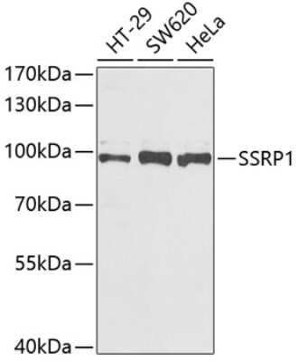 Western Blot: SSRP1 Antibody [NBP2-93977] - Analysis of extracts of various cell lines, using SSRP1 . Exposure time: 90s.