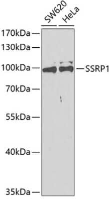 Western Blot: SSRP1 Antibody [NBP2-94578] - Analysis of extracts of various cell lines, using SSRP1 antibody at 1:400 dilution.Secondary antibody: HRP Goat Anti-Rabbit IgG (H+L)  at 1:10000 dilution.Lysates/proteins: 25ug per lane. Blocking buffer: 3% nonfat dry milk in TBST.Detection: ECL Basic Kit. Exposure time: 90s.