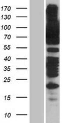 Western Blot: SSRP1 Overexpression Lysate (Adult Normal) [NBP2-08033] Left-Empty vector transfected control cell lysate (HEK293 cell lysate); Right -Over-expression Lysate for SSRP1.