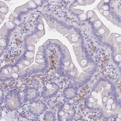 Immunohistochemistry-Paraffin: SSU-2 Antibody [NBP2-14692] - Staining of human small intestine shows cytoplasmic positivity in immune cells.