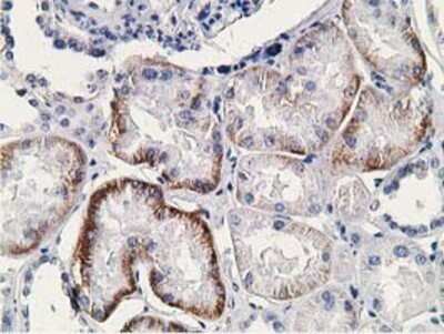 Immunohistochemistry: SSX1 Antibody (OTI1E10) - Azide and BSA Free [NBP2-74362] - Staining of paraffin-embedded Human Kidney tissue using anti-SSX1 mouse monoclonal antibody.