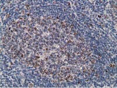 Immunohistochemistry: SSX1 Antibody (OTI1E10) - Azide and BSA Free [NBP2-74362] - Staining of paraffin-embedded Human lymph node tissue using anti-SSX1 mouse monoclonal antibody.