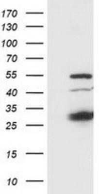 Western Blot: SSX1 Antibody (OTI1E10) - Azide and BSA Free [NBP2-74362] - HEK293T cells were transfected with the pCMV6-ENTRY control (Left lane) or pCMV6-ENTRY SSX1 (Right lane) cDNA for 48 hrs and lysed. Equivalent amounts of cell lysates (5 ug per lane) were separated by SDS-PAGE and immunoblotted with anti-SSX1.