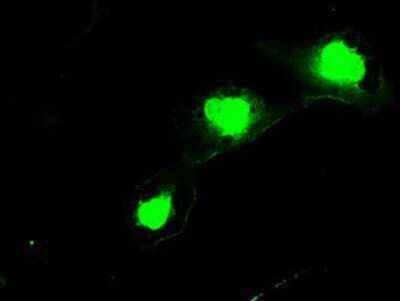 Immunocytochemistry/Immunofluorescence: SSX2 Antibody (4D10) [NBP1-48008] Staining of COS7 cells transiently transfected by pCMV6-ENTRY SSX2.