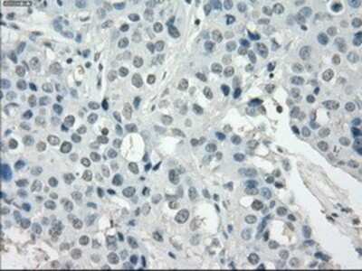 Immunohistochemistry-Paraffin SSX2 Antibody (OTI4D10)