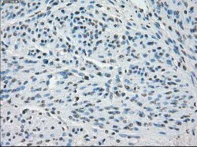 Immunohistochemistry-Paraffin: SSX2 Antibody (4D10) [NBP1-48008] - Staining of paraffin-embedded endometrium tissue using anti-SSX2 mouse monoclonal antibody.