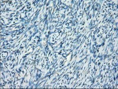 Immunohistochemistry-Paraffin: SSX2 Antibody (4D10) [NBP1-48008] - Staining of paraffin-embedded Ovary tissue using anti-SSX2 mouse monoclonal antibody.