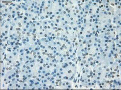 Immunohistochemistry-Paraffin: SSX2 Antibody (4D10) [NBP1-48008] - Staining of paraffin-embedded pancreas tissue using anti-SSX2 mouse monoclonal antibody.