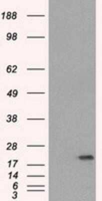 Western Blot SSX2 Antibody (OTI4D10)