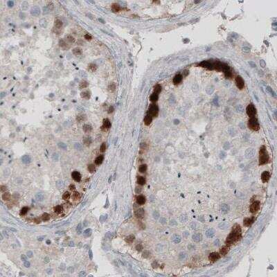 Immunohistochemistry: SSX2 Antibody (CL3202) [NBP2-42398] - Staining of human testis shows strong nuclear immunoreactivity in a subset of cells in seminiferous tubules.