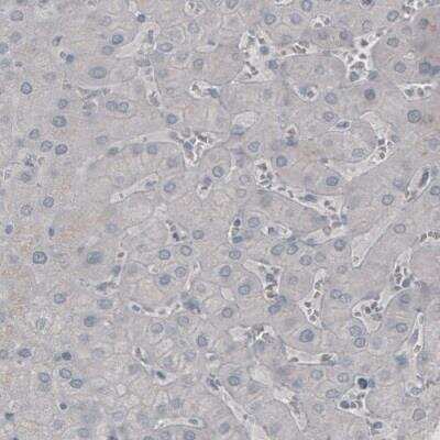 Immunohistochemistry: SSX2 Antibody (CL3202) [NBP2-42398] - Staining of human liver shows absence of immunoreactivity in hepatocytes (negative control).