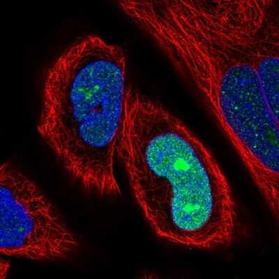 Immunocytochemistry/ Immunofluorescence SSX2 Antibody