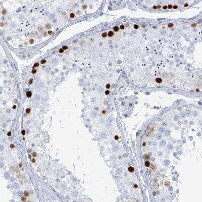 Immunohistochemistry: SSX2 Antibody [NBP2-46717] - Staining of human testis shows strong nuclear positivity in a subset of cells in seminiferus ducts.