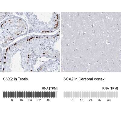 Immunohistochemistry-Paraffin: SSX2 Antibody [NBP2-46717] - Analysis in human testis and cerebral cortex tissues using NBP2-46717 antibody. Corresponding SSX2 RNA-seq data are presented for the same tissues.