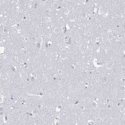 Immunohistochemistry-Paraffin: SSX2 Antibody [NBP2-46717] - Staining of human Cerebral cortex shows no positivity in neuronal cells as expected.