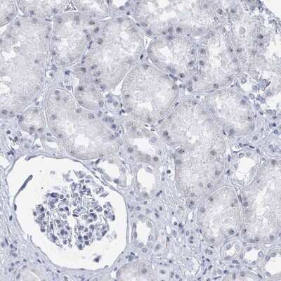 Immunohistochemistry-Paraffin: SSX2 Antibody [NBP2-46717] - Staining of human Kidney shows no positivity in cells in tubules as expected.