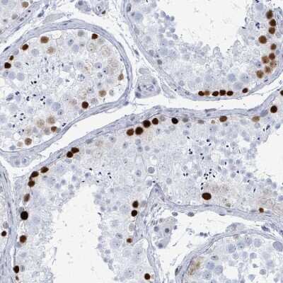 Immunohistochemistry-Paraffin: SSX2 Antibody [NBP2-46717] - Staining of human Testis shows strong nuclear positivity in spermatogonia.