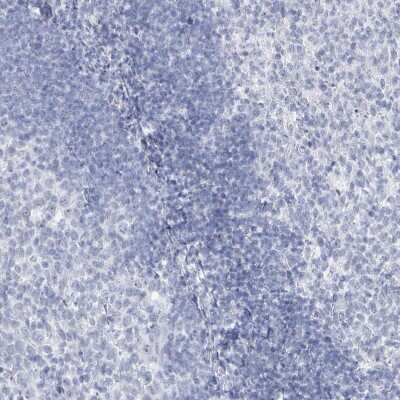 Immunohistochemistry-Paraffin: SSX2 Antibody [NBP2-46717] - Staining of human Tonsil shows no positivity in non-germinal center cells as expected.