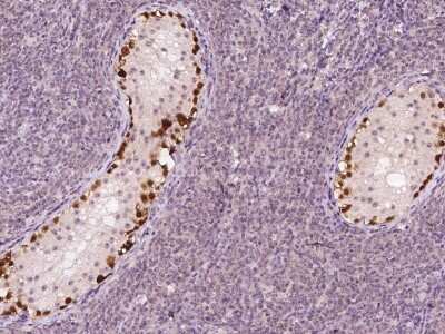 Immunohistochemistry-Paraffin: SSX2 Antibody [NBP2-98127] - Immunochemical staining of human SSX2 in human testis with rabbit polyclonal antibody at 1:100 dilution, formalin-fixed paraffin embedded sections.