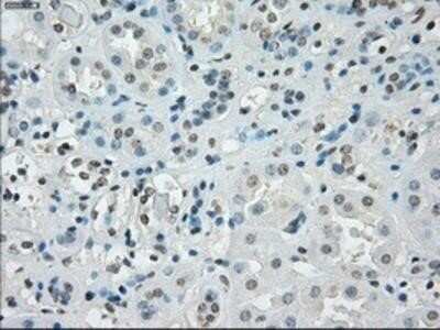 Immunohistochemistry: SSX2 Antibody (OTI4D10) - Azide and BSA Free [NBP2-74368] - SSX2 Antibody (4D10) [NBP1-48008