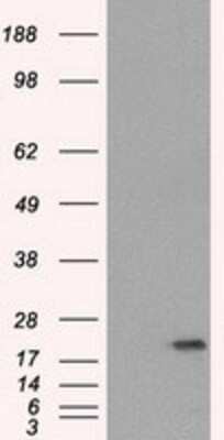 Western Blot: SSX2 Antibody (OTI4D10) - Azide and BSA Free [NBP2-74368] - HEK293T cells were transfected with the pCMV6-ENTRY control (Left lane) or pCMV6-ENTRY SSX2 (Right lane) cDNA for 48 hrs and lysed. Equivalent amounts of cell lysates (5 ug per lane) were separated by SDS-PAGE and immunoblotted with anti-SSX2.