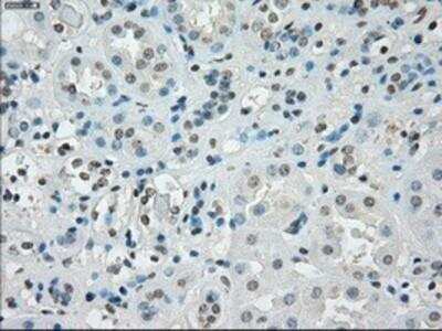 Immunohistochemistry-Paraffin SSX2 Antibody (OTI4D10)