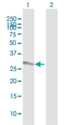 Western Blot: SSX2 Antibody [H00006757-B01P] - Analysis of SSX2 expression in transfected 293T cell line by SSX2 polyclonal antibody.  Lane 1: SSX2 transfected lysate(24.64 KDa). Lane 2: Non-transfected lysate.