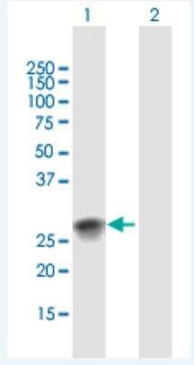 Western Blot: SSX2 Antibody [H00006757-B02P-50ug] - Analysis of SSX2 expression in transfected 293T cell line (H00006757-T02) by SSX2 MaxPab polyclonal antibody.  Lane 1: SSX2 transfected lysate(20.79 KDa). Lane 2: Non-transfected lysate.