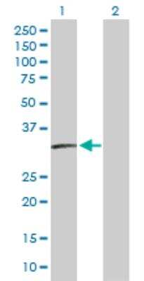 Western Blot: SSX2 Antibody [H00006757-D01F] - analysis of SSX2 expression in transfected 293T cell line by SSX2 affinity purified MaxPab rabbit polyclonal antibody. Lane 1: SSX2 transfected lysate (24.64 KDa). Lane 2: Non-transfected lysate.